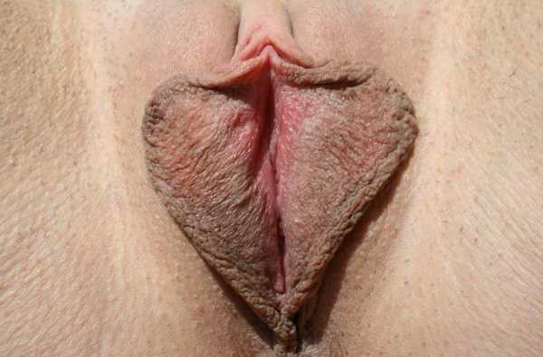 половые губы женщины - 14